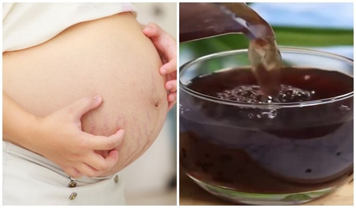 Đậu đen sẽ rất tốt cho sức khỏe của chính mình và cả đứa bé trong bụng
